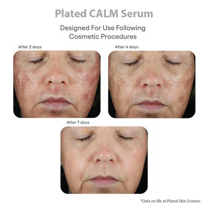 (plated) CALM Serum