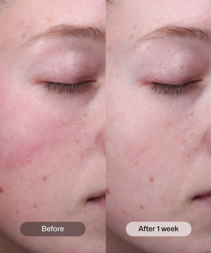 Radiance+ Resurfacing Serum 1 oz & Sleep Mask